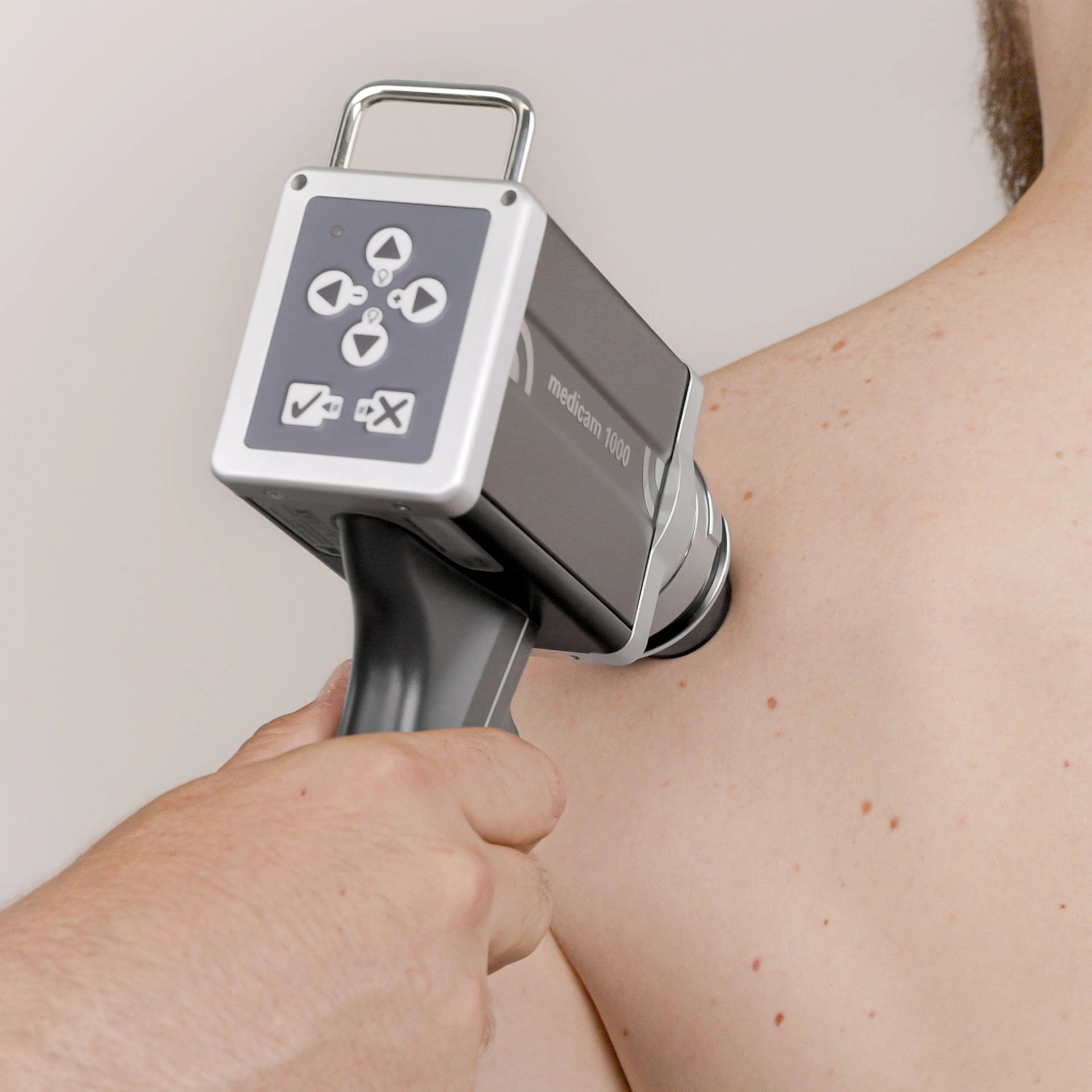 Close view of a FotoFinder medicam 1000 in contact with a patient’s upper back during skin imaging.