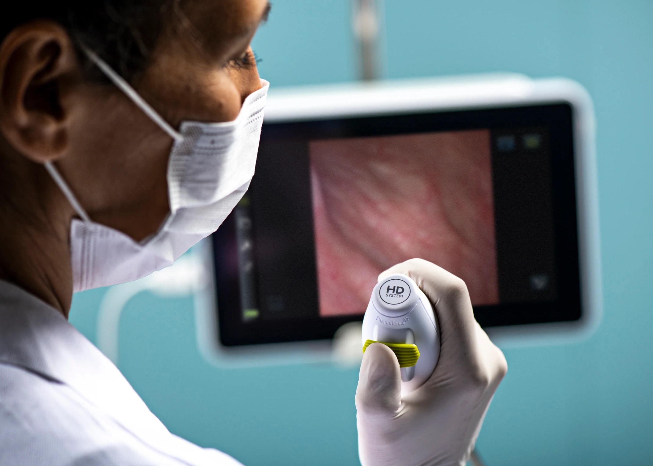 A masked clinician holds an Ambu cystoscope beside an endoscopy display.